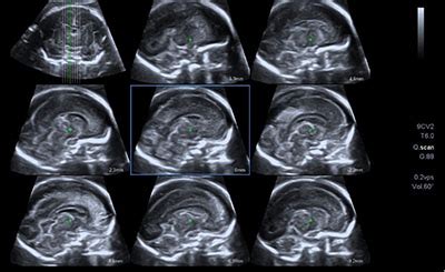 Ecografia ostetrica professionale eseguita con apparecchiature ad alta risoluzione
