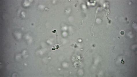 Spermatozoi con morfologie varie visti al microscopio