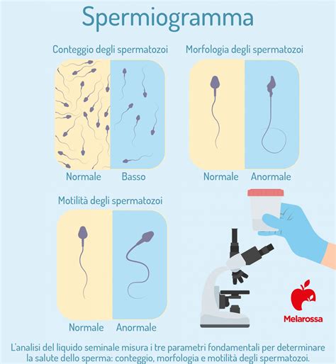 Preparazione per lo spermiogramma