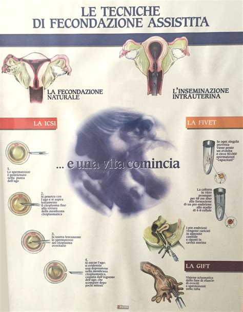 Micro-TESE: recupero spermatozoi dal testicolo