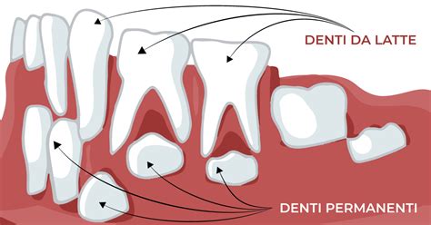 Illustrazione di un dente da latte sorridente con una coroncina