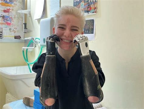 Bebe Vio in posa con le sue protesi