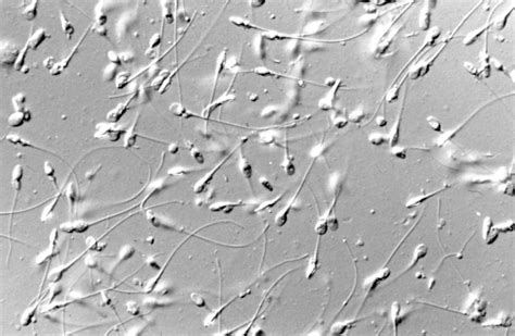 Microscopio con spermatozoi in preparazione per la fecondazione