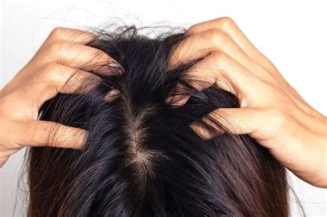 Mani che applicano delicatamente olio sul cuoio capelluto di un neonato