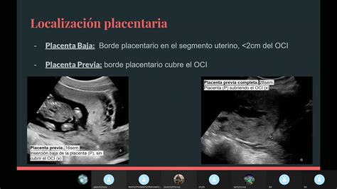Ecografia che mostra una placenta bassa
