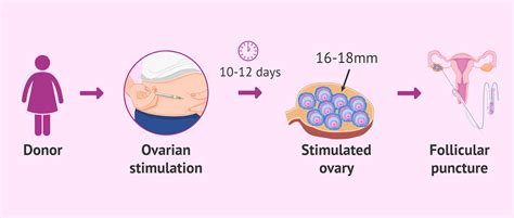 Ovarian Stimulation Process