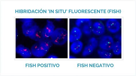 Microscopio con immagine FISH