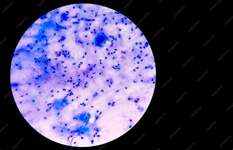 Microscopio che mostra batteri vaginali sani