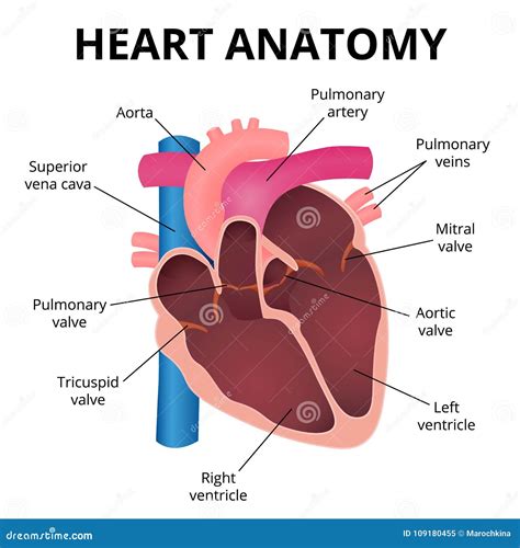 illustrazione anatomica del cuore umano con evidenza delle strutture sinistre ipoplasiche