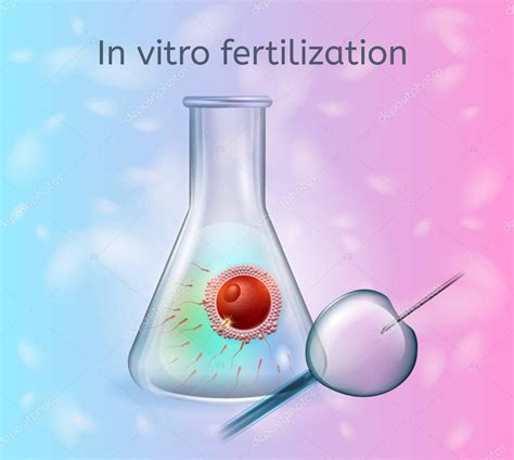 Illustrazione del processo di fecondazione in vitro