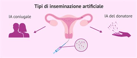 Infografica che confronta i costi medi di inseminazione artificiale e fecondazione in vitro