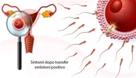 Sintomi comuni dopo transfer