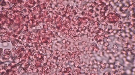 Emoglobina e cellule sanguigne al microscopio