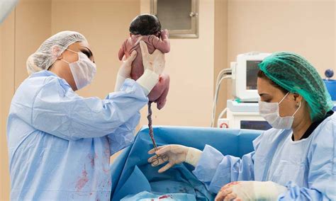 Donazione sangue cordonale