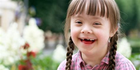 bambina sorridente con sindrome di down