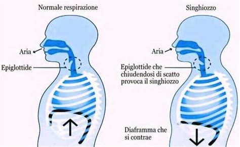 Neonato che fa il singhiozzo