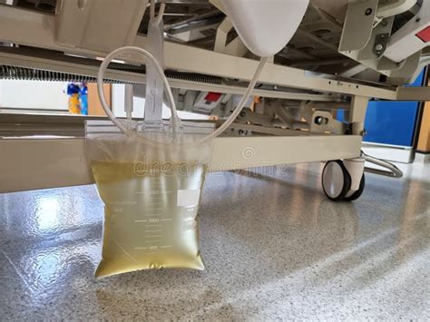 Applicazione del sacchetto per urine in neonate
