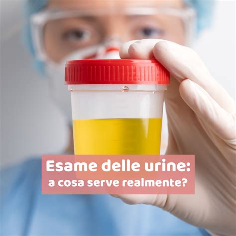 Genitore che tenta la raccolta urine 