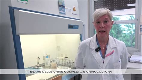 Spiegazione dei parametri dell'esame urine completo