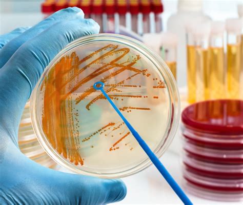 Processo di urinocoltura in laboratorio