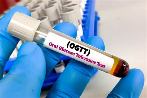 Infografica sulla procedura del Test da Carico Orale di Glucosio (OGTT)