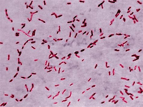 Microscopio con batteri Bordetella pertussis