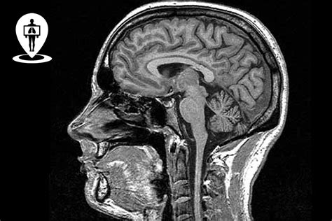 Risonanza magnetica cerebrale di un neonato