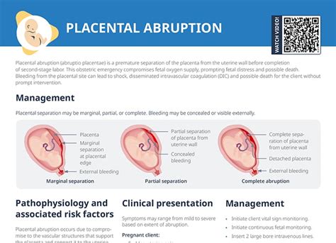 Types of placental abruption diagram
