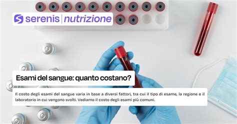 Tabella riassuntiva delle preparazioni per diversi esami del sangue