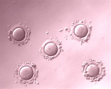 Microscopio e ovociti in laboratorio di PMA