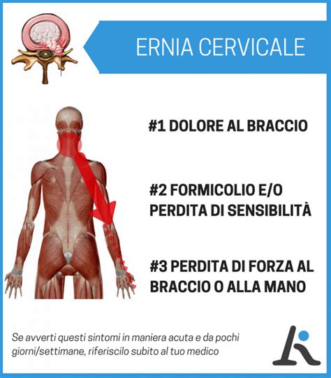 Illustrazione dei sintomi comuni dell'ectropion cervicale