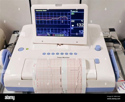 Cardiotocografia (CTG) monitor