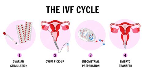 Infografica: Fasi del trattamento FIV