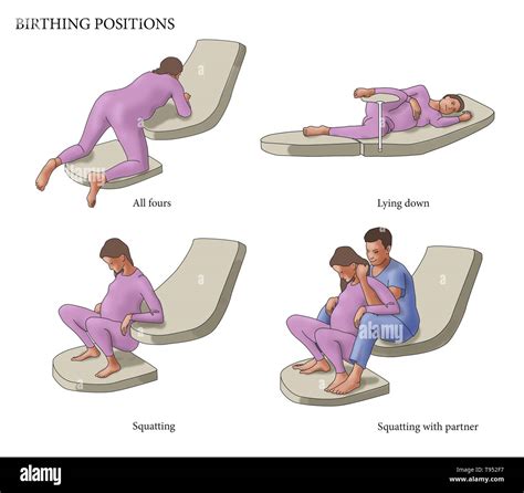 Diagram of various childbirth positions
