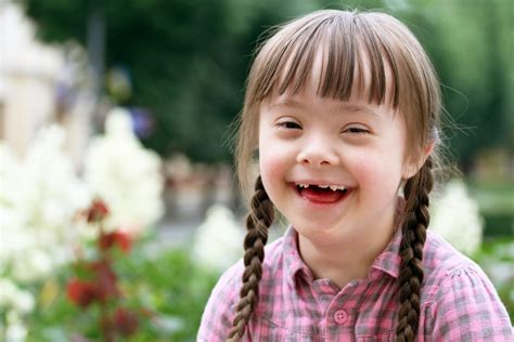 bambino con caratteristiche sindrome di Down