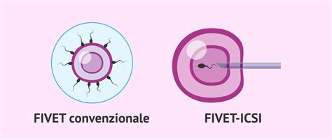 Processo FIVET e ICSI