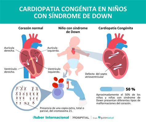 Schema di cardiopatia congenita