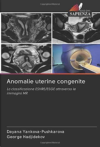 Schema delle anomalie congenite dei genitali femminili