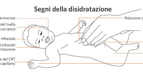 bambino con segni di disidratazione