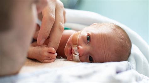 Bambino prematuro in cura, con contatto pelle a pelle con il genitore