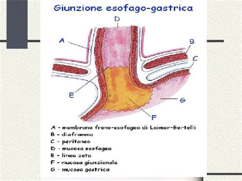 Diagramma dell'esofago e dello stomaco con enfasi sulla giunzione gastroesofagea
