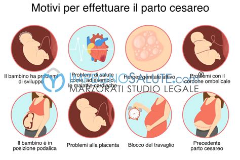 Comparazione tra gli obiettivi dell'IVG e del taglio cesareo