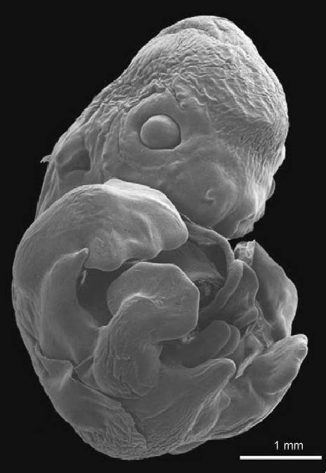 Embrione umano al microscopio
