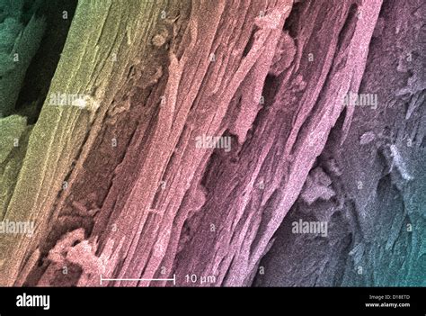 Micrografia elettronica a scansione di Coxiella burnetii