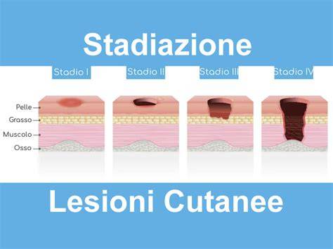 Diagramma che mostra le diverse lesioni istologiche placentari