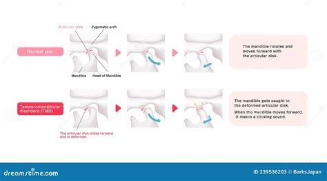 Illustrazione comparativa delle caratteristiche chiave dei paracapezzoli adesivi (es. traspirabilità, aderenza, invisibilità)