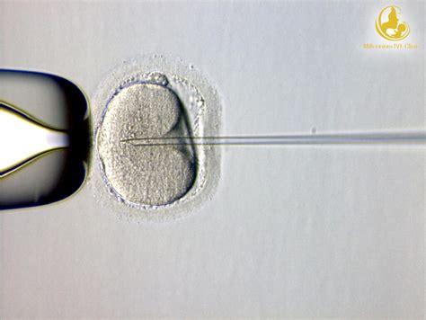 Immagine della microiniezione ICSI