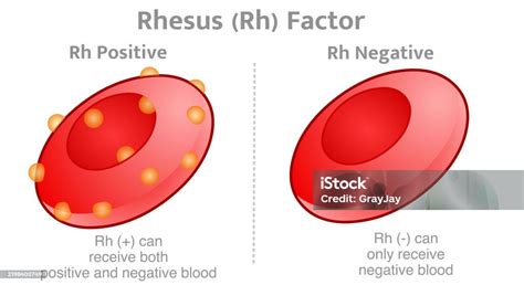 Schema che illustra l'ereditarietà del fattore Rh e le probabilità di un figlio Rh negativo da genitori Rh positivi eterozigoti.