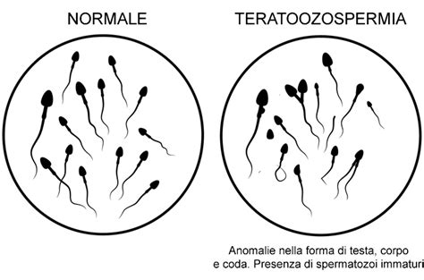 rappresentazione microscopica di spermatozoi sani e mobili
