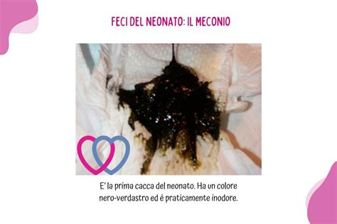 Schema delle prime feci del neonato: meconio e feci di transizione